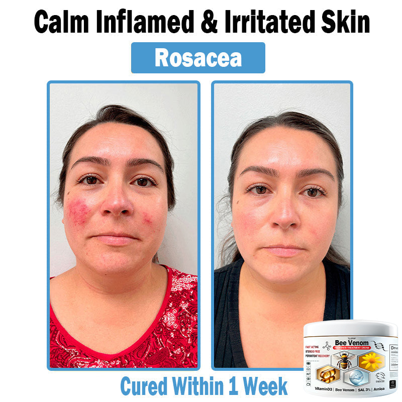 BEE ๐ฝ๐๐๐๐ ๐ด๐๐๐๐-๐บ๐๐๐๐๐๐ ๐บ๐๐๐ ๐ป๐๐๐๐๐๐๐๐ ๐ช๐๐๐๐ (TLOPAยฎ ๐จโโ๐ต๐ท๐ญ ๐น๐ฌ๐ช๐ถ๐ด๐ด๐ฌ๐ต๐ซ๐บ๐
)