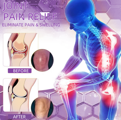 𝐎𝐟𝐟𝐢𝐜𝐢𝐚𝐥 𝐒𝐭𝐨𝐫𝐞: 𝐓𝐋𝐎𝐏𝐀® 𝑺𝒉𝒂𝒓𝒌 𝑪𝒂𝒓𝒕𝒊𝒍𝒂𝒈𝒆 𝑷𝒂𝒊𝒏-𝑺𝒐𝒐𝒕𝒉𝒊𝒏𝒈 𝑩𝒐𝒏𝒆 𝑹𝒆𝒄𝒐𝒗𝒆𝒓𝒚 𝑮𝒆𝒍 👨‍⚕️(5-𝗆𝗂𝗇𝗎𝗍𝖾 𝗉𝖺𝗂𝗇 𝗋𝖾𝗅𝗂𝖾𝖿, 𝟩 𝖽𝖺𝗒𝗌 𝗍𝗈 𝗋𝖾𝗌𝗍𝗈𝗋𝖾 𝗃𝗈𝗂𝗇𝗍 𝗆𝗈𝖻𝗂𝗅𝗂𝗍𝗒, 𝟦 𝗐𝖾𝖾𝗄𝗌 𝖿𝗈𝗋 𝖼𝗈𝗆𝗉𝗅𝖾𝗍𝖾 𝗁𝖾𝖺𝗅𝗂𝗇𝗀)🔥