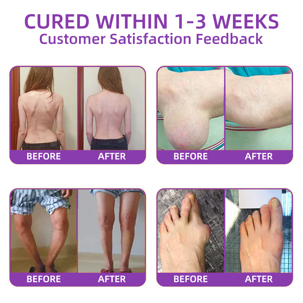 𝐎𝐟𝐟𝐢𝐜𝐢𝐚𝐥 𝐒𝐭𝐨𝐫𝐞: 𝐓𝐋𝐎𝐏𝐀® 𝑺𝒉𝒂𝒓𝒌 𝑪𝒂𝒓𝒕𝒊𝒍𝒂𝒈𝒆 𝑷𝒂𝒊𝒏-𝑺𝒐𝒐𝒕𝒉𝒊𝒏𝒈 𝑩𝒐𝒏𝒆 𝑹𝒆𝒄𝒐𝒗𝒆𝒓𝒚 𝑮𝒆𝒍 👨‍⚕️(5-𝗆𝗂𝗇𝗎𝗍𝖾 𝗉𝖺𝗂𝗇 𝗋𝖾𝗅𝗂𝖾𝖿, 𝟩 𝖽𝖺𝗒𝗌 𝗍𝗈 𝗋𝖾𝗌𝗍𝗈𝗋𝖾 𝗃𝗈𝗂𝗇𝗍 𝗆𝗈𝖻𝗂𝗅𝗂𝗍𝗒, 𝟦 𝗐𝖾𝖾𝗄𝗌 𝖿𝗈𝗋 𝖼𝗈𝗆𝗉𝗅𝖾𝗍𝖾 𝗁𝖾𝖺𝗅𝗂𝗇𝗀)🔥