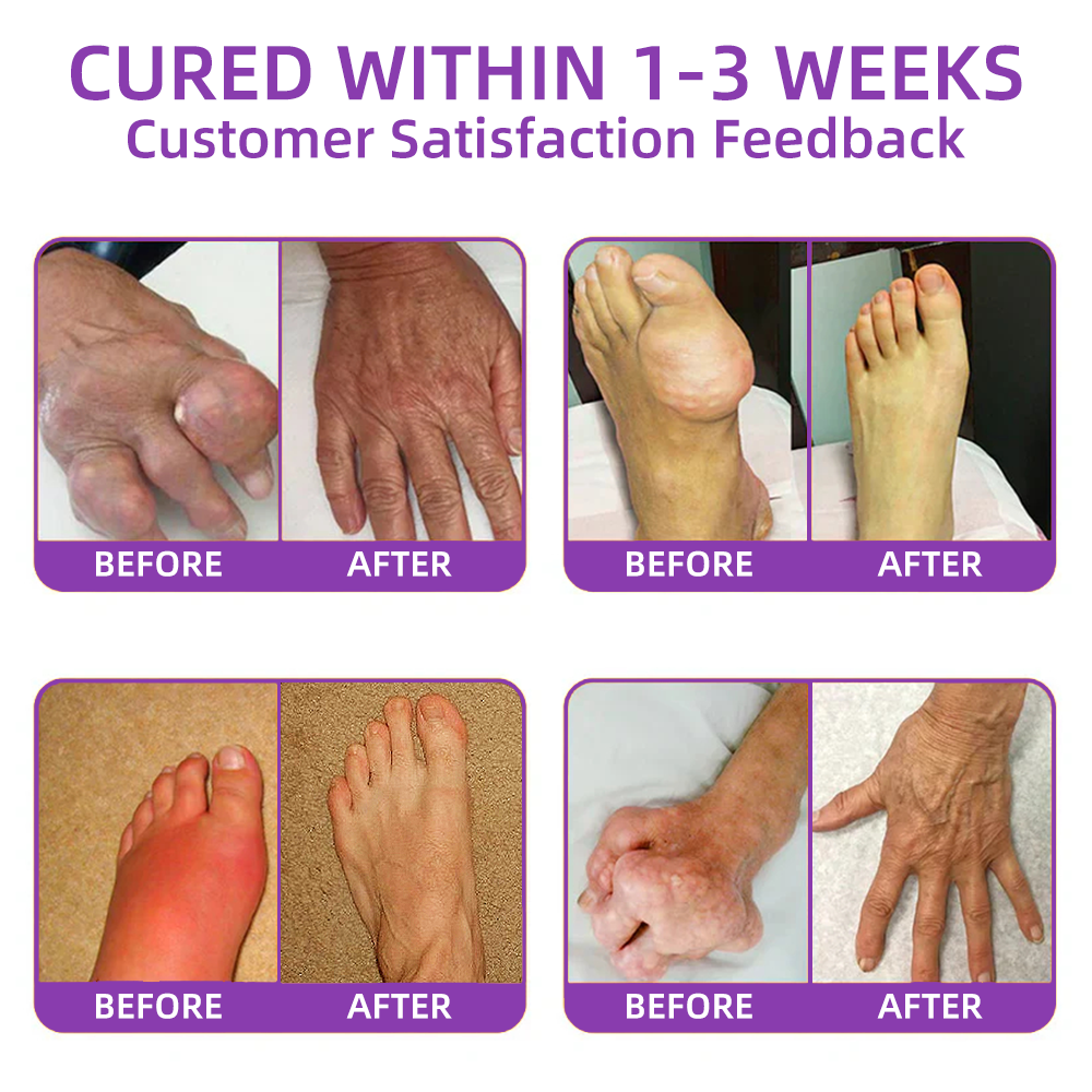 4 Jars 🔥-nitial relief & Immediate pain relief