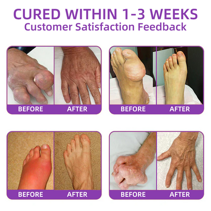 𝐎𝐟𝐟𝐢𝐜𝐢𝐚𝐥 𝐒𝐭𝐨𝐫𝐞: 𝐓𝐋𝐎𝐏𝐀® 𝑺𝒉𝒂𝒓𝒌 𝑪𝒂𝒓𝒕𝒊𝒍𝒂𝒈𝒆 𝑷𝒂𝒊𝒏-𝑺𝒐𝒐𝒕𝒉𝒊𝒏𝒈 𝑩𝒐𝒏𝒆 𝑹𝒆𝒄𝒐𝒗𝒆𝒓𝒚 𝑮𝒆𝒍 👨‍⚕️(5-𝗆𝗂𝗇𝗎𝗍𝖾 𝗉𝖺𝗂𝗇 𝗋𝖾𝗅𝗂𝖾𝖿, 𝟩 𝖽𝖺𝗒𝗌 𝗍𝗈 𝗋𝖾𝗌𝗍𝗈𝗋𝖾 𝗃𝗈𝗂𝗇𝗍 𝗆𝗈𝖻𝗂𝗅𝗂𝗍𝗒, 𝟦 𝗐𝖾𝖾𝗄𝗌 𝖿𝗈𝗋 𝖼𝗈𝗆𝗉𝗅𝖾𝗍𝖾 𝗁𝖾𝖺𝗅𝗂𝗇𝗀)🔥